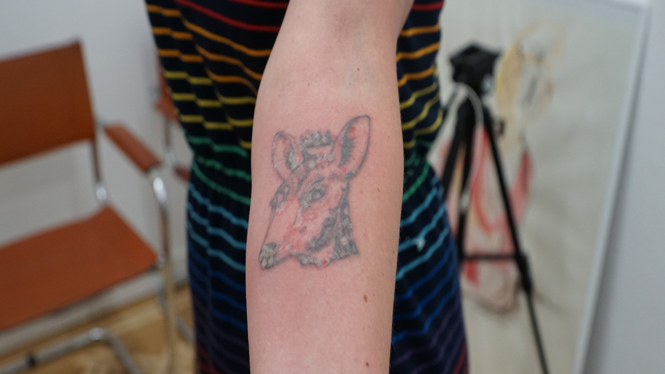 Tattoos müssen nicht für immer sein Beitragsbild Tattoos müssen nicht für immer sein